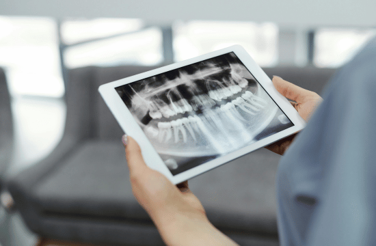 Invisalign White City Dent