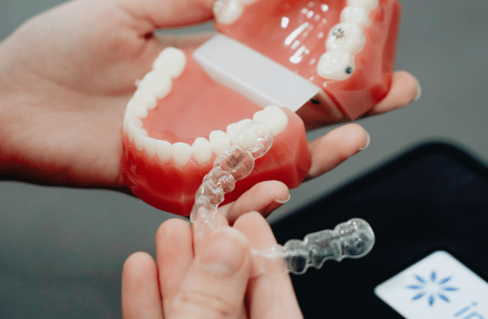 Invisalign White City Dent