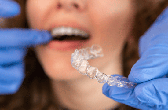 Invisalign White City Dent