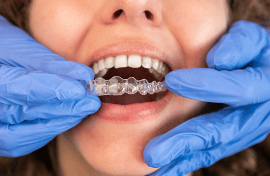 Invisalign White City Dent